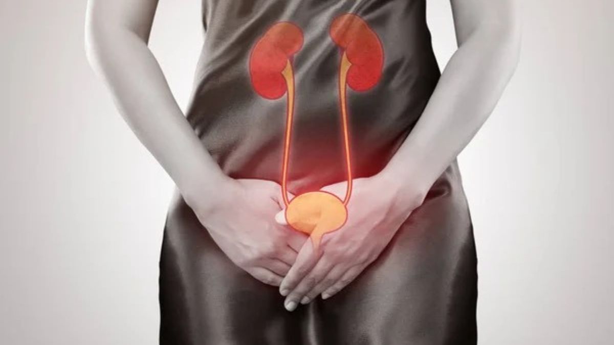 Ilustração dos rins destacando infecção urinária avançada e pielonefrite